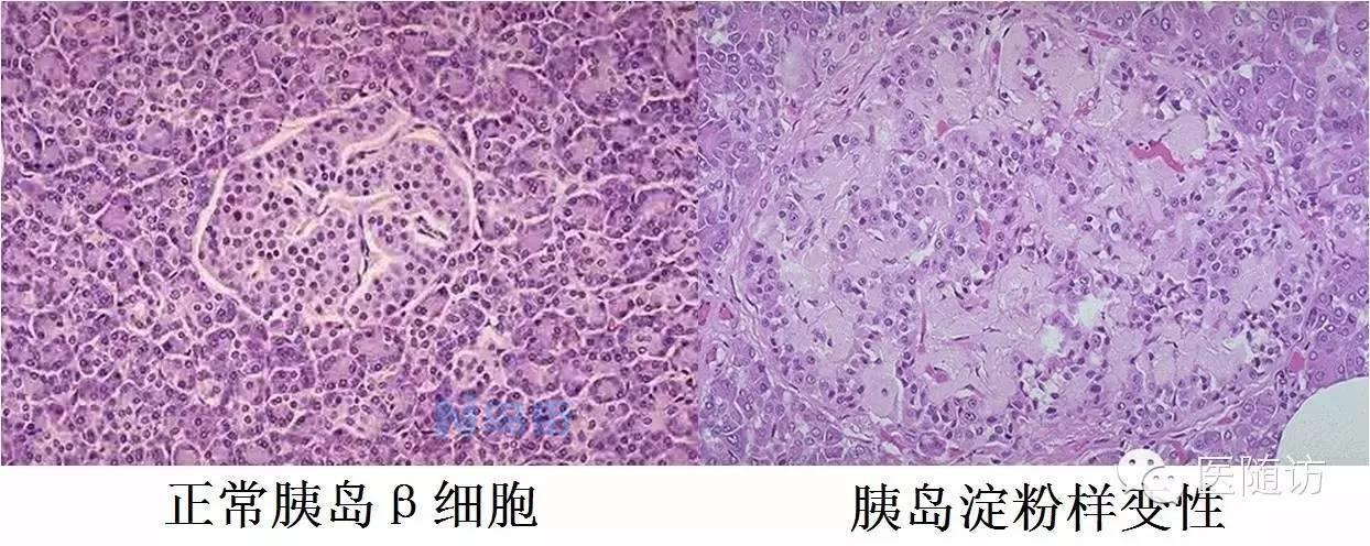 关于猫肾淀粉样变性的治疗办法