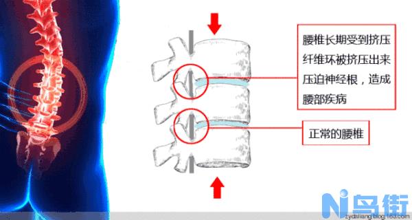 金毛腰间盘突出会痛吗，金毛腰间盘突出要去医院吗?