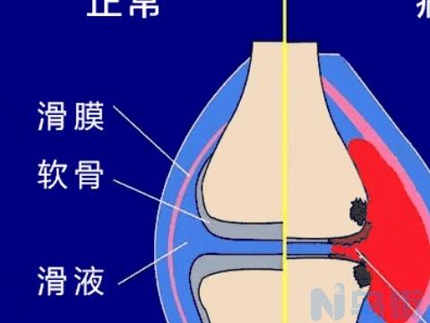 引起犬髋关节发育不良的病因以及症状是什么？