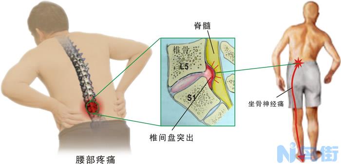 狗狗腰椎疼痛是什么症状？