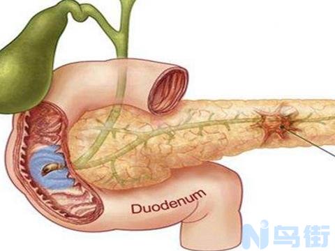 金毛胰腺炎症状？