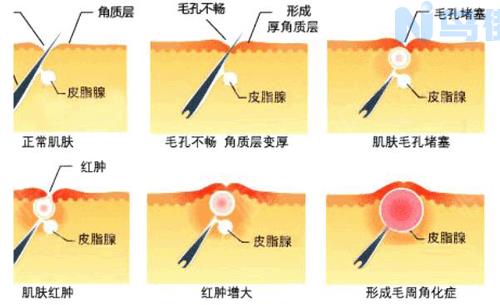 果酸钓鱼什么季节用效果最好